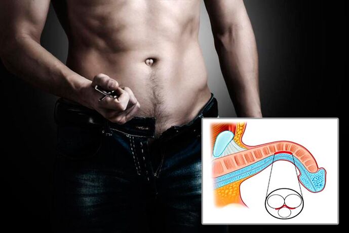 Мард парвозро барои машқҳои васеъ кардани penis пардохт мекунад
